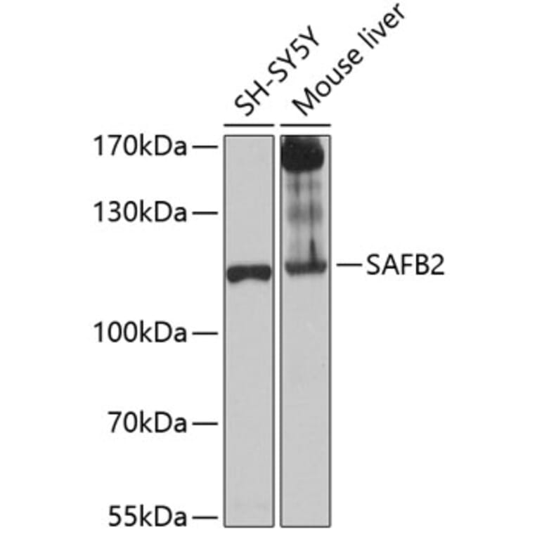 Western Blot - Anti-SAFB2 Antibody (A12550) - Antibodies.com