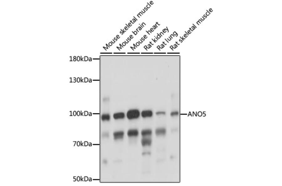 Western Blot - Anti-anoctamin 5 Antibody (A87804) - Antibodies.com