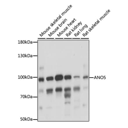 Western Blot - Anti-anoctamin 5 Antibody (A87804) - Antibodies.com