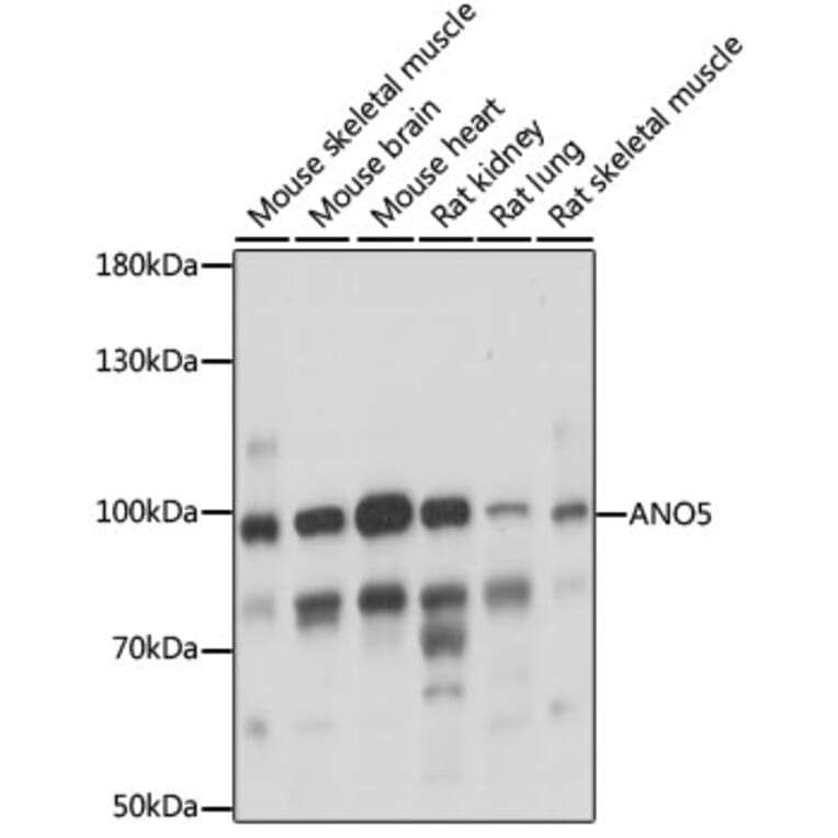 Western Blot - Anti-anoctamin 5 Antibody (A87804) - Antibodies.com