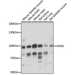 Western Blot - Anti-anoctamin 5 Antibody (A87804) - Antibodies.com