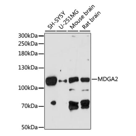 Western Blot - Anti-MDGA2 Antibody (A87805) - Antibodies.com