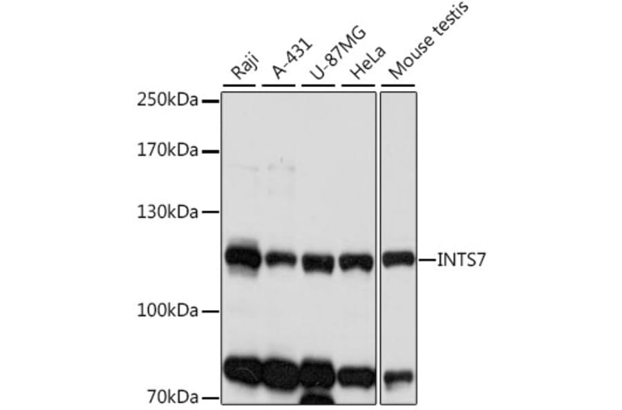Western Blot - Anti-INTS7 Antibody (A87806) - Antibodies.com