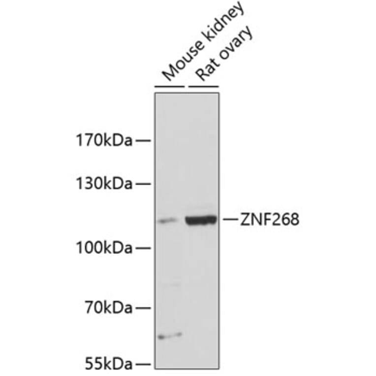 Western Blot - Anti-ZNF268 Antibody (A87809) - Antibodies.com