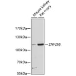 Western Blot - Anti-ZNF268 Antibody (A87809) - Antibodies.com