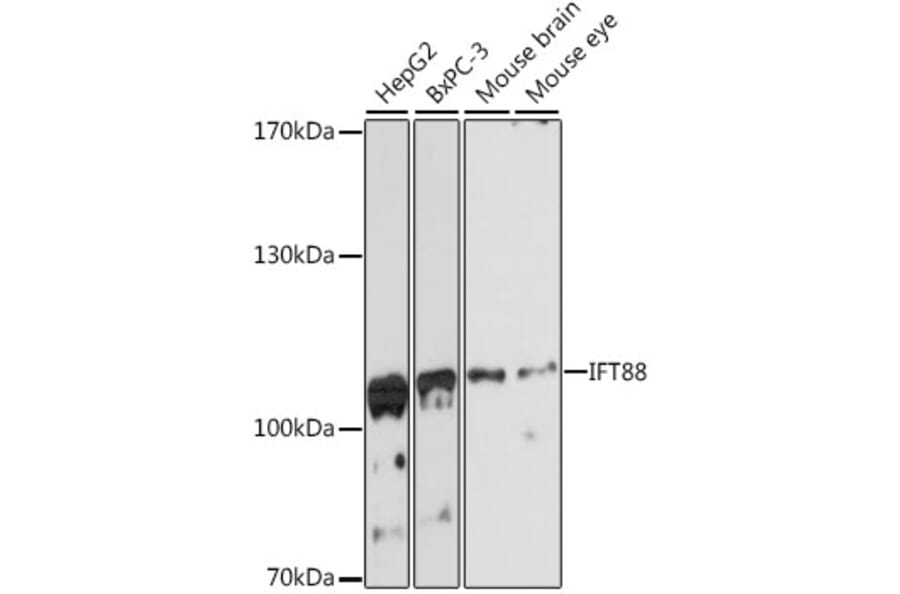 Western Blot - Anti-IFT88 Antibody (A87810) - Antibodies.com