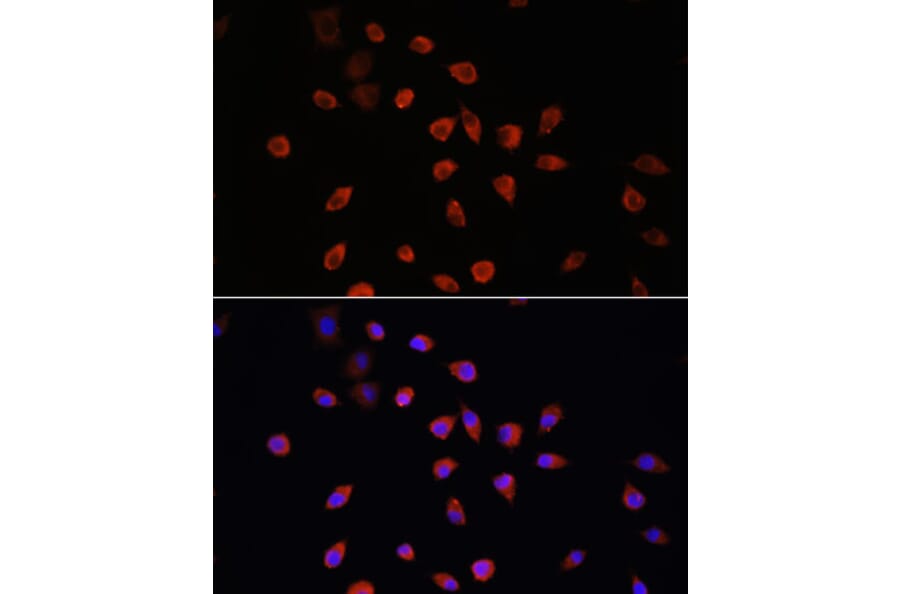 Immunofluorescence - Anti-IFT88 Antibody (A87810) - Antibodies.com