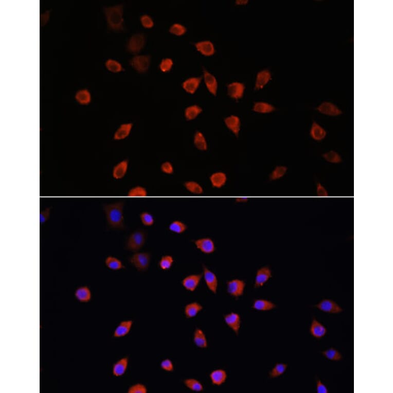 Immunofluorescence - Anti-IFT88 Antibody (A87810) - Antibodies.com