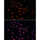 Immunofluorescence - Anti-IFT88 Antibody (A87810) - Antibodies.com