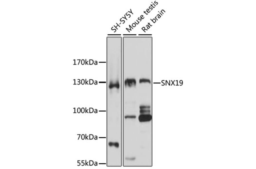 Western Blot - Anti-SNX19 Antibody (A5229) - Antibodies.com