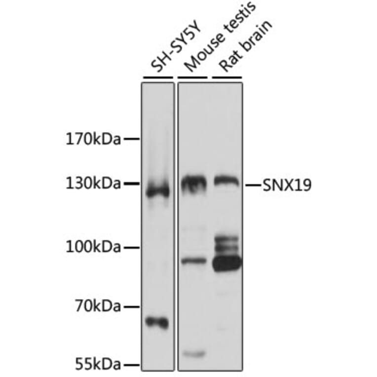 Western Blot - Anti-SNX19 Antibody (A5229) - Antibodies.com