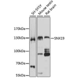Western Blot - Anti-SNX19 Antibody (A5229) - Antibodies.com