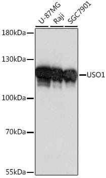 Western blot analysis of extracts of various cell lines, using Anti-USO1 Antibody (A16079) at 1:1,000 dilution.
Secondary antibody: Goat Anti-Rabbit IgG (H+L) (HRP) (AS014) at 1:10,000 dilution.
Lysates / proteins: 25µg per lane.
Blocking buffer: 3% non-fat dry milk in TBST.
Detection: ECL Basic Kit (RM00020).
Exposure time: 1s.