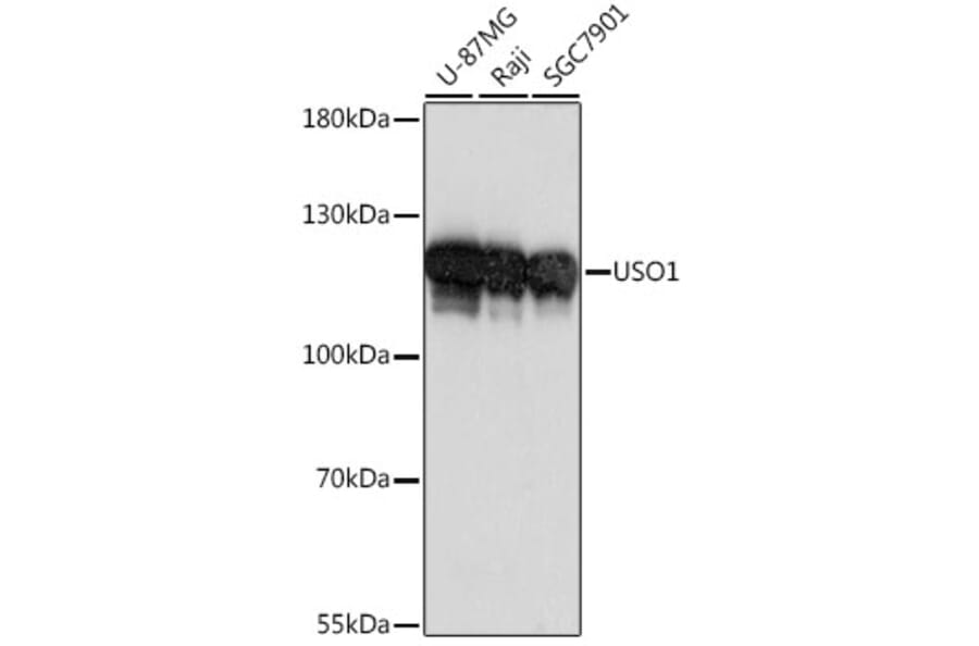 Western Blot - Anti-USO1 Antibody (A87812) - Antibodies.com