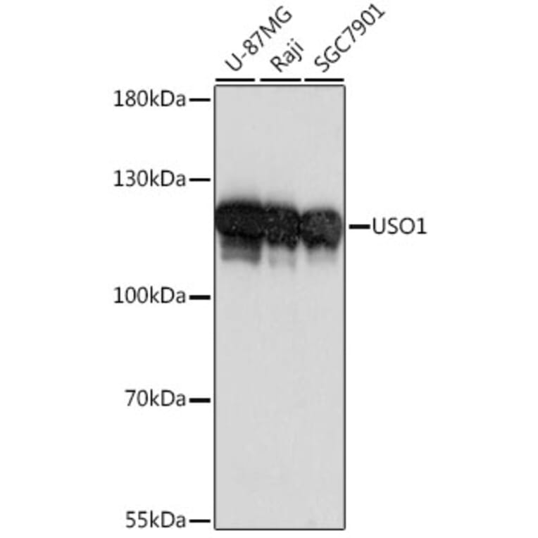 Western Blot - Anti-USO1 Antibody (A87812) - Antibodies.com
