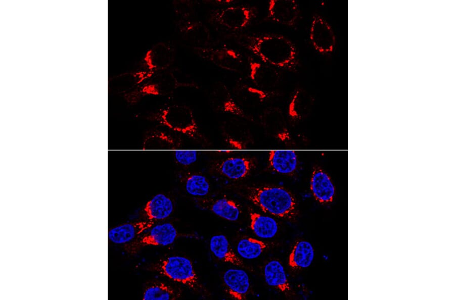 Immunofluorescence - Anti-USO1 Antibody (A87812) - Antibodies.com
