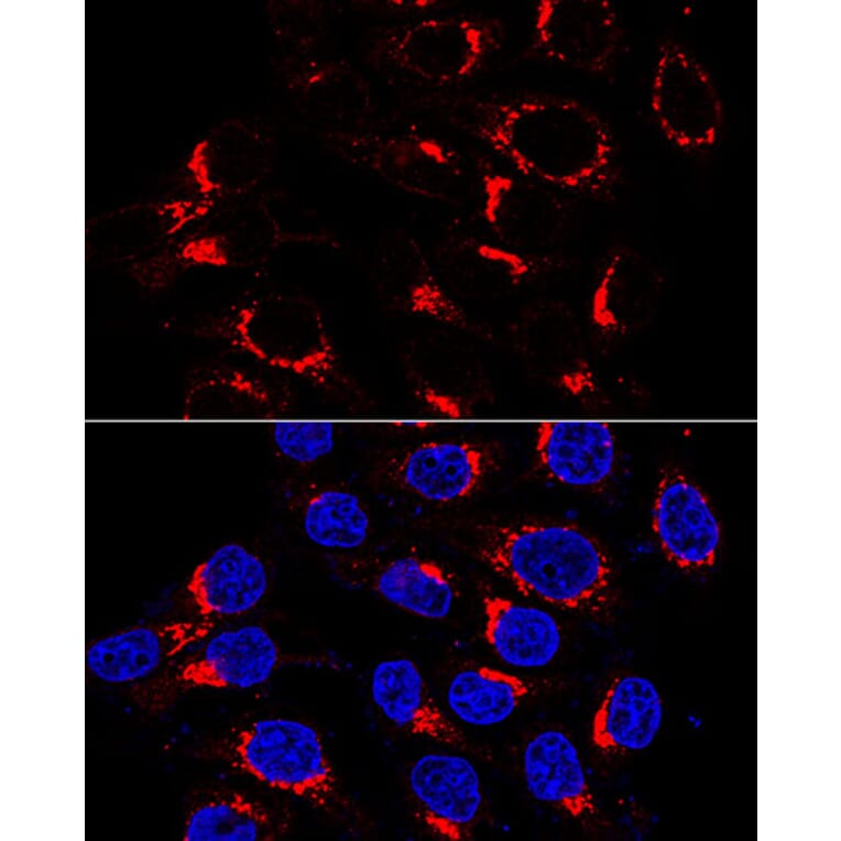 Immunofluorescence - Anti-USO1 Antibody (A87812) - Antibodies.com