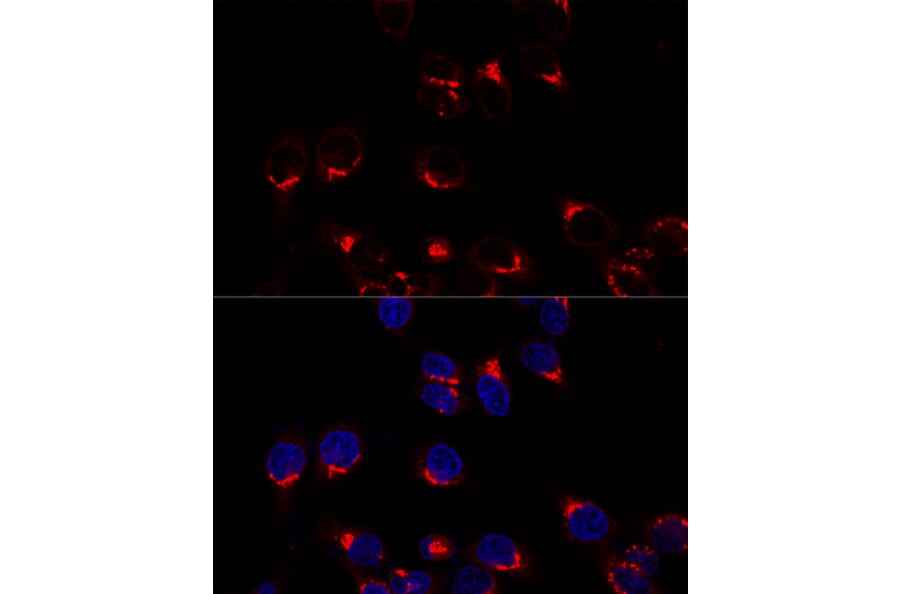 Immunofluorescence - Anti-USO1 Antibody (A87812) - Antibodies.com