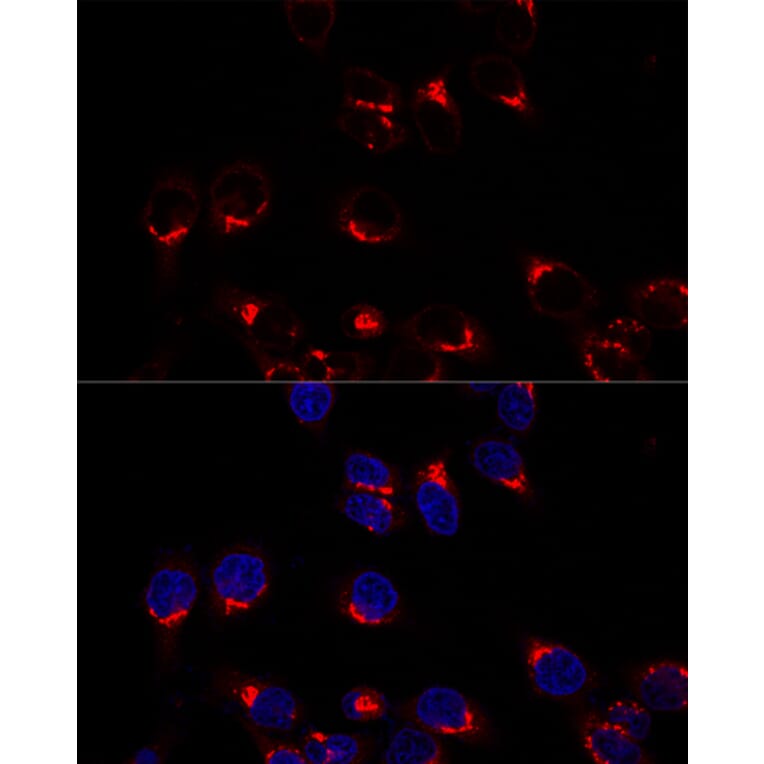 Immunofluorescence - Anti-USO1 Antibody (A87812) - Antibodies.com