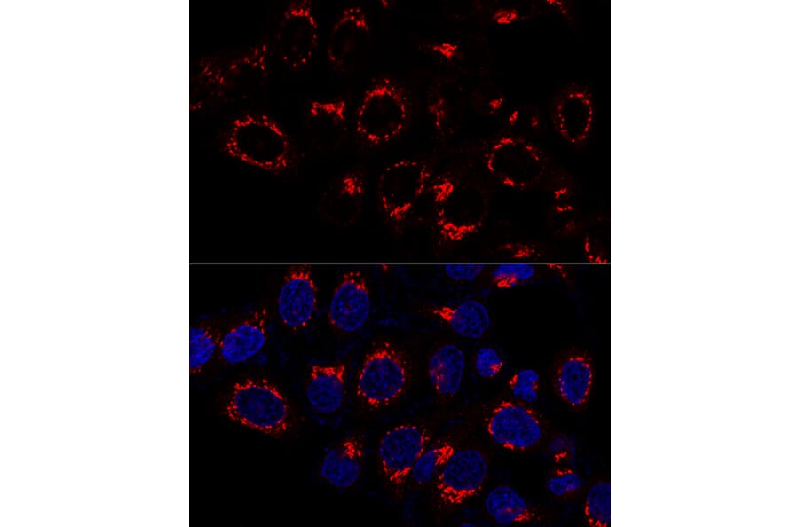 Immunofluorescence - Anti-USO1 Antibody (A87812) - Antibodies.com