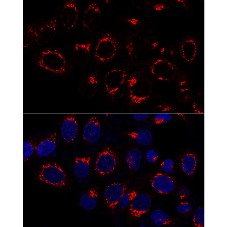 Immunofluorescence - Anti-USO1 Antibody (A87812) - Antibodies.com