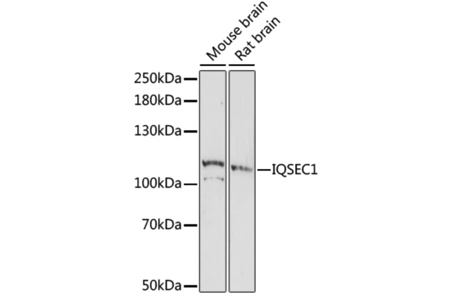 Western Blot - Anti-BRAG2 Antibody (A87815) - Antibodies.com