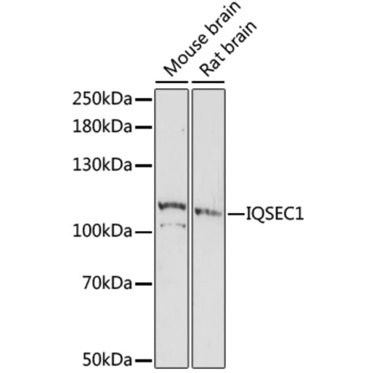 Western Blot - Anti-BRAG2 Antibody (A87815) - Antibodies.com