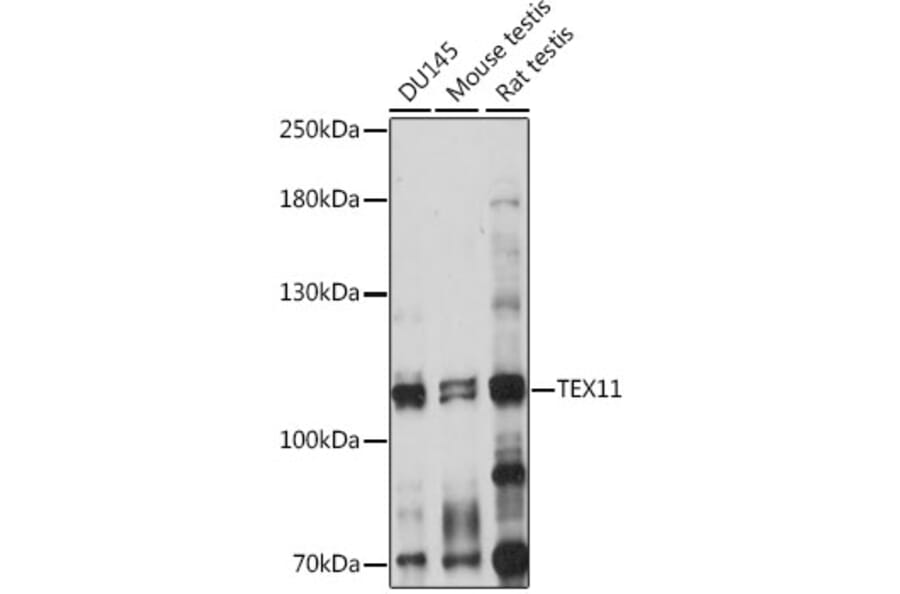Western Blot - Anti-TEX11 Antibody (A87816) - Antibodies.com