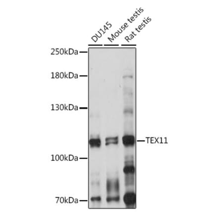 Western Blot - Anti-TEX11 Antibody (A87816) - Antibodies.com