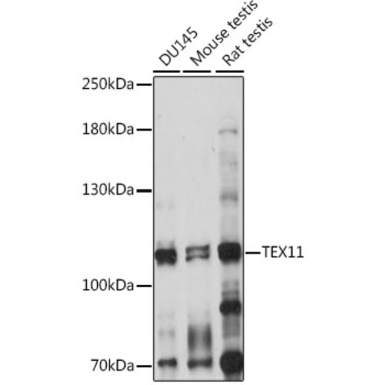 Western Blot - Anti-TEX11 Antibody (A87816) - Antibodies.com