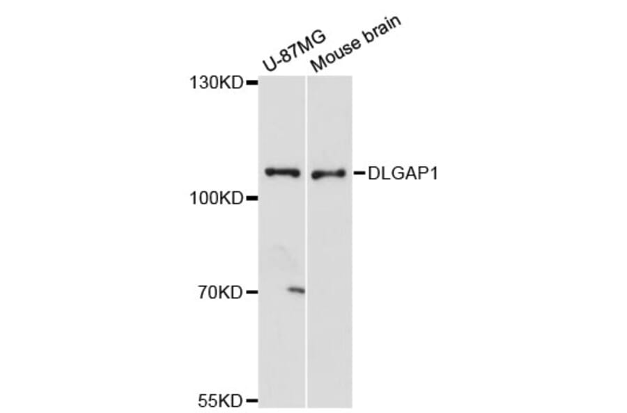 Western Blot - Anti-DLGAP1 Antibody (A13060) - Antibodies.com