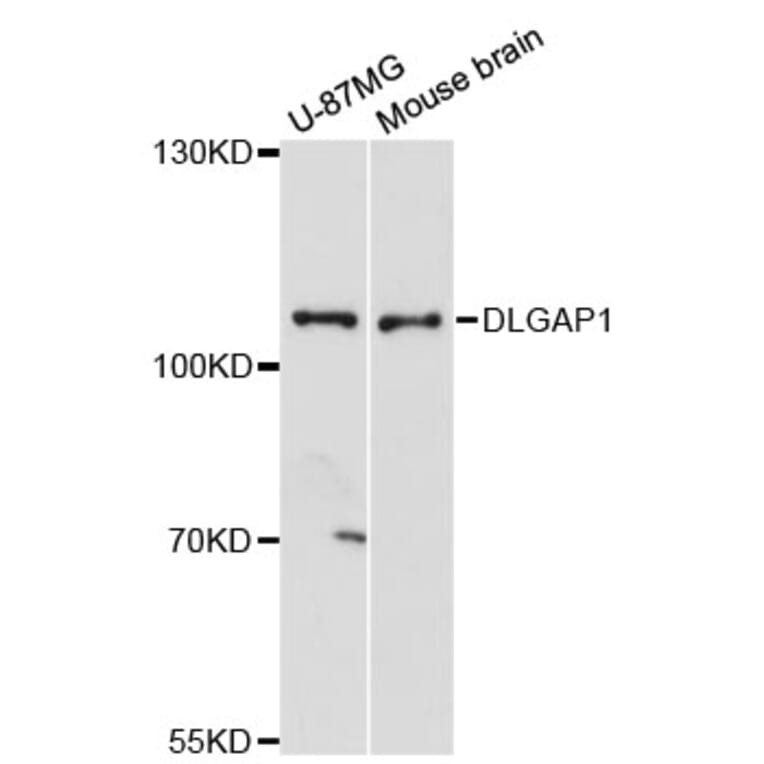 Western Blot - Anti-DLGAP1 Antibody (A13060) - Antibodies.com