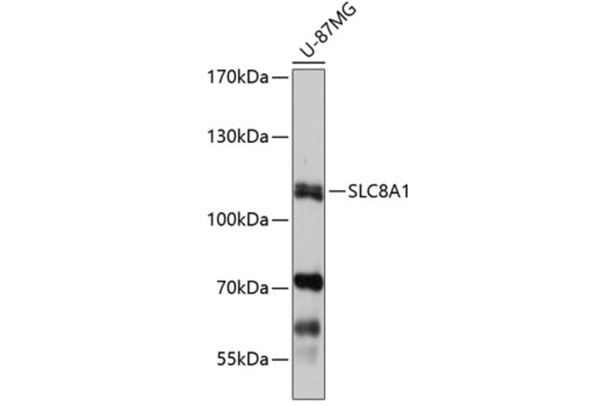 Western Blot - Anti-SLC8A1 Antibody (A7419) - Antibodies.com