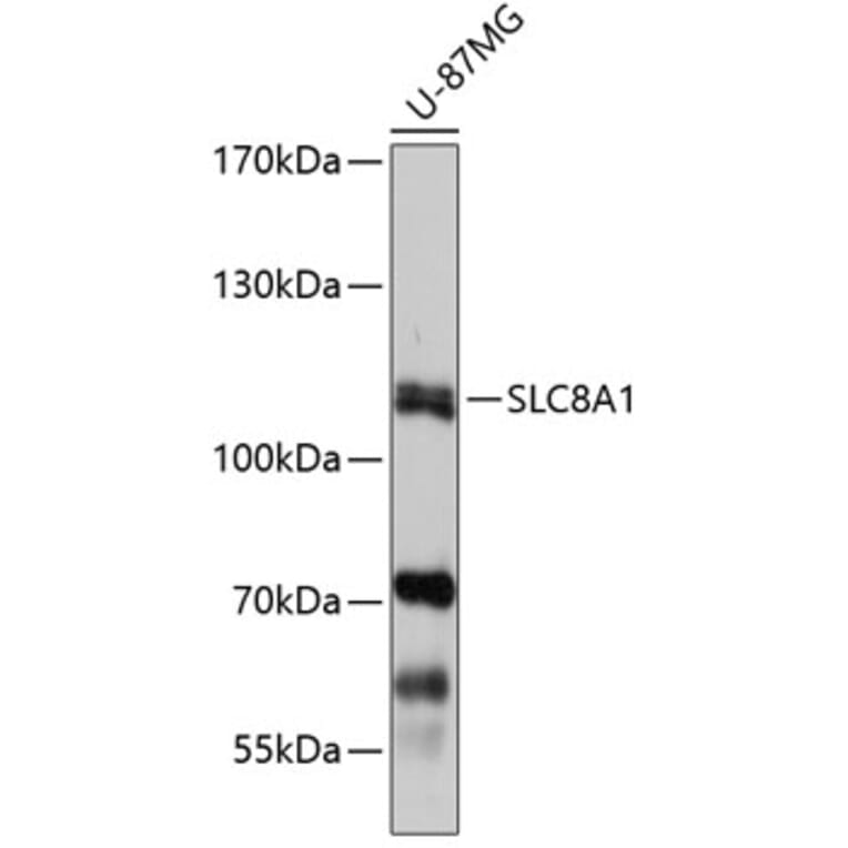 Western Blot - Anti-SLC8A1 Antibody (A7419) - Antibodies.com