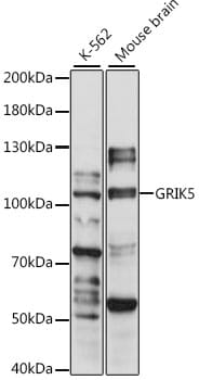 Western blot analysis of extracts of various cell lines, using Anti-GRIK5 Antibody (A15676) at 1:1,000 dilution.
Secondary antibody: Goat Anti-Rabbit IgG (H+L) (HRP) (AS014) at 1:10,000 dilution.
Lysates / proteins: 25µg per lane.
Blocking buffer: 3% non-fat dry milk in TBST.
Detection: ECL Basic Kit (RM00020).
Exposure time: 30s.
