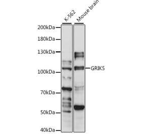 Western Blot - Anti-GluK5 Antibody (A87819) - Antibodies.com