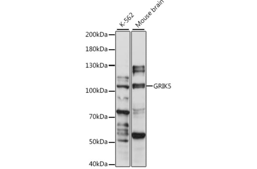 Western Blot - Anti-GluK5 Antibody (A87819) - Antibodies.com