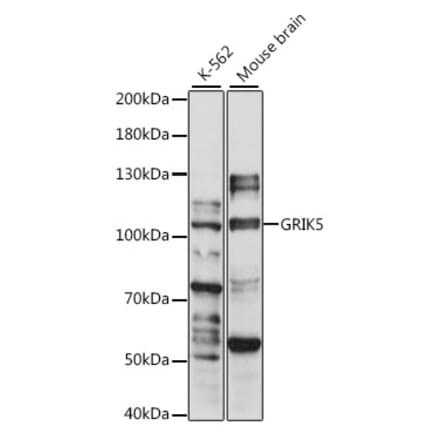 Western Blot - Anti-GluK5 Antibody (A87819) - Antibodies.com