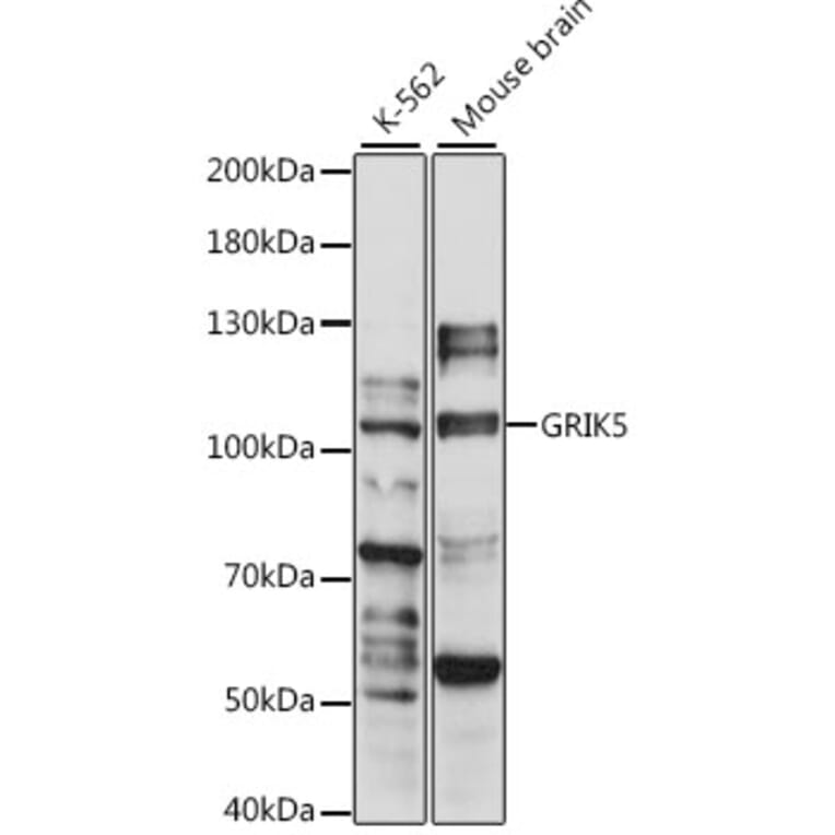 Western Blot - Anti-GluK5 Antibody (A87819) - Antibodies.com