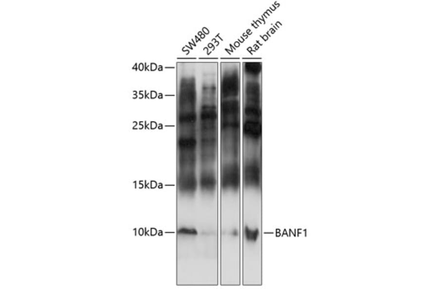 Western Blot - Anti-BANF1/BAF Antibody (A87821) - Antibodies.com