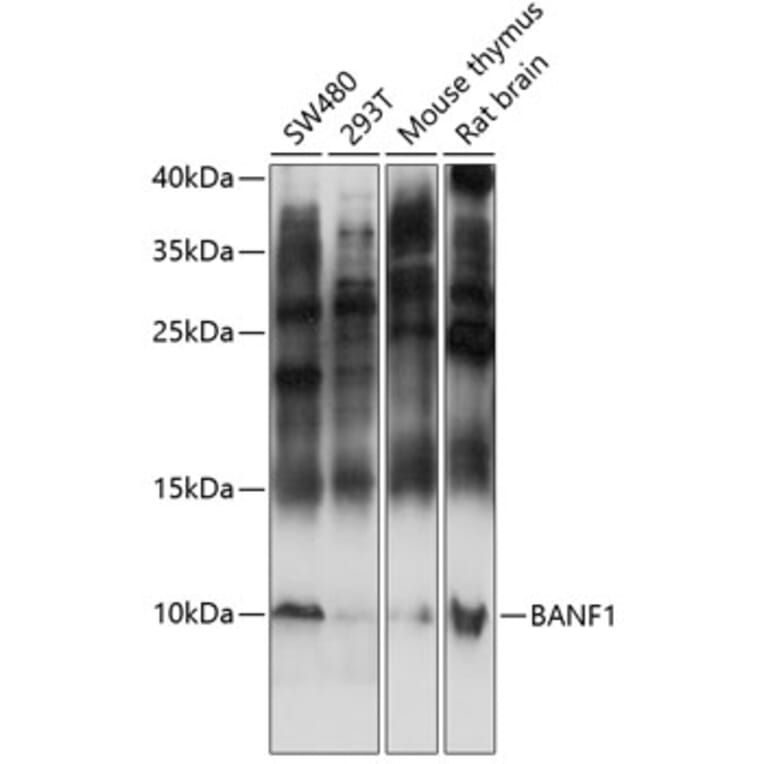 Western Blot - Anti-BANF1/BAF Antibody (A87821) - Antibodies.com