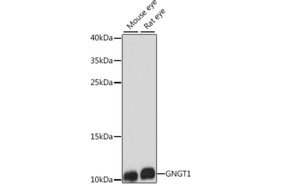 Western Blot - Anti-GNGT1 Antibody (A87822) - Antibodies.com