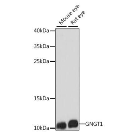 Western Blot - Anti-GNGT1 Antibody (A87822) - Antibodies.com