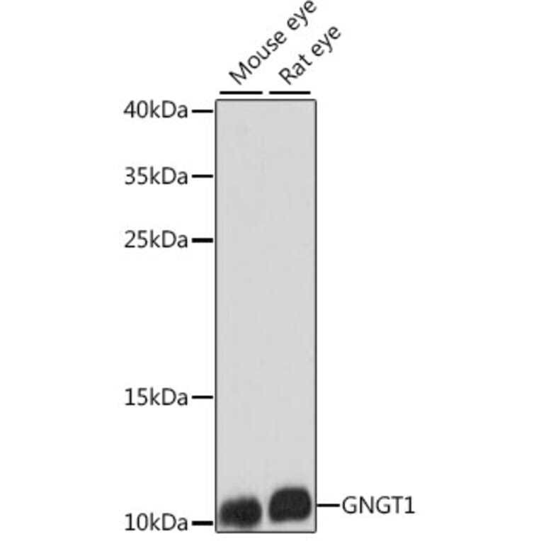 Western Blot - Anti-GNGT1 Antibody (A87822) - Antibodies.com