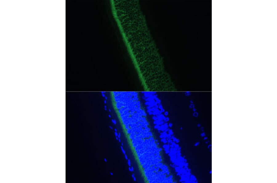 Immunofluorescence - Anti-GNGT1 Antibody (A87822) - Antibodies.com