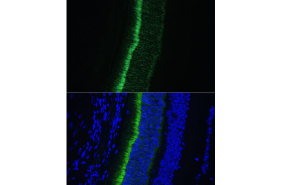 Immunofluorescence - Anti-GNGT1 Antibody (A87822) - Antibodies.com