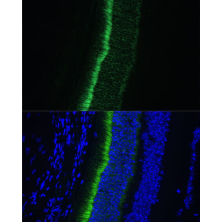 Immunofluorescence - Anti-GNGT1 Antibody (A87822) - Antibodies.com