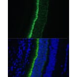 Immunofluorescence - Anti-GNGT1 Antibody (A87822) - Antibodies.com