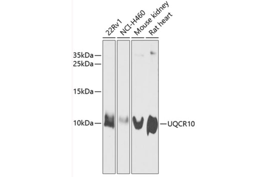 Western Blot - Anti-Cytochrome b-c1 complex subunit 9/UQCR10 Antibody (A87823) - Antibodies.com