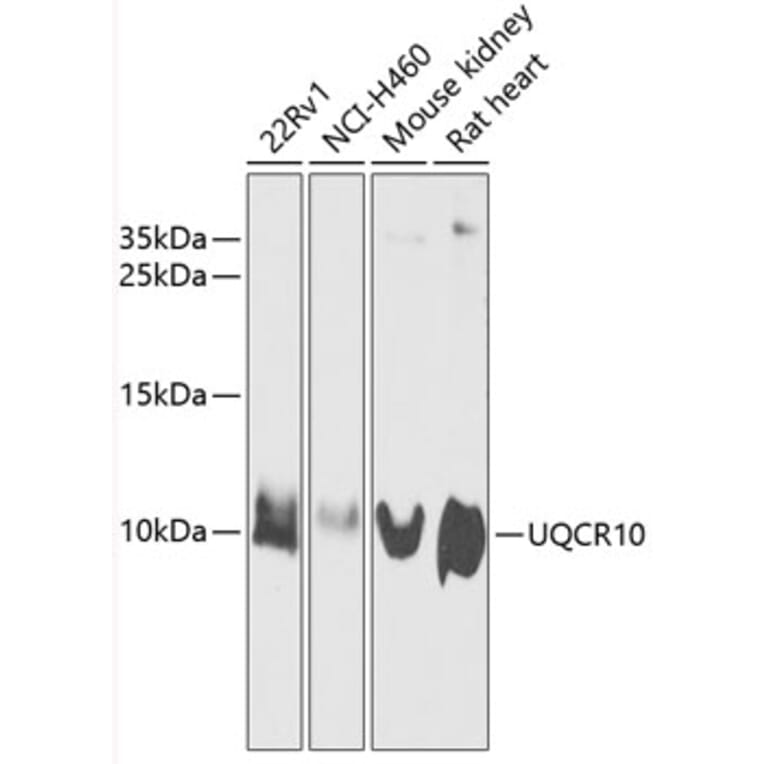 Western Blot - Anti-Cytochrome b-c1 complex subunit 9/UQCR10 Antibody (A87823) - Antibodies.com
